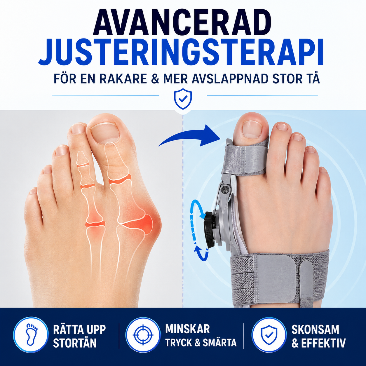 ErgoHallux™ Tåkorrigerare